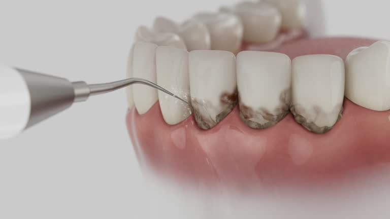 Reliable Dental Implants contractor in Progreso, TX by Smile Center Dentistry
